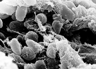 Illustration for article titled A Few Mutant Genes Can Turn a Stomach Bug into the Black Death